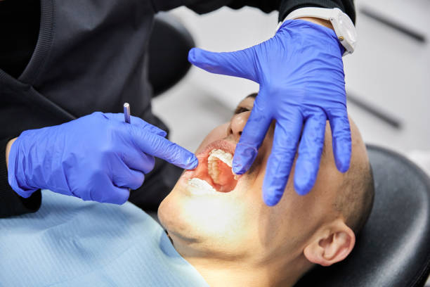 Best Emergency Wisdom Teeth Removal in Pottstown, PA